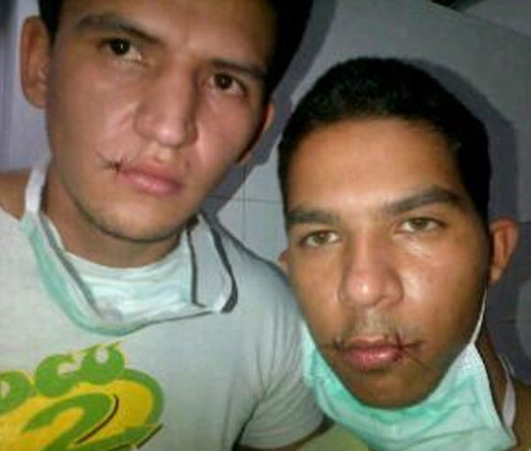 Estudiantes del Zulia se cosen los labios como protesta (Fotos)