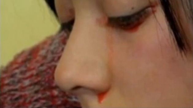 Joven chilena llora sangre (Foto + video)