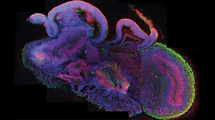 Científicos austriacos crean el primer cerebro hecho en un laboratorio