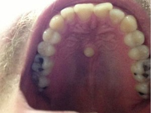 El diente más raro que una persona puede tener (foto)