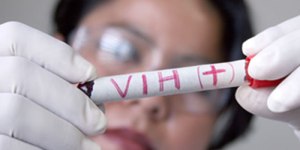 El VIH puede ser erradicado en 15 años, según la OMS