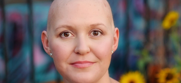 Cuidados especiales que deben recibir pacientes en quimioterapia