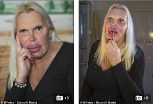 La increíble transformación de este hombre en mujer tras seis cirugías (Fotos)