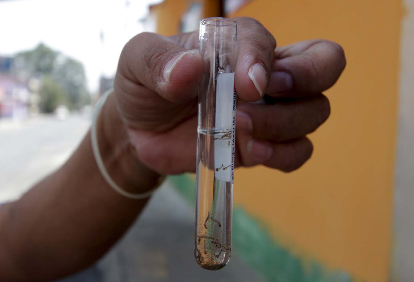 España registra primer caso de embarazada con zika en Europa, proviene de Colombia