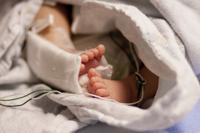 Operan a un bebé recién nacido por error (VIDEO)