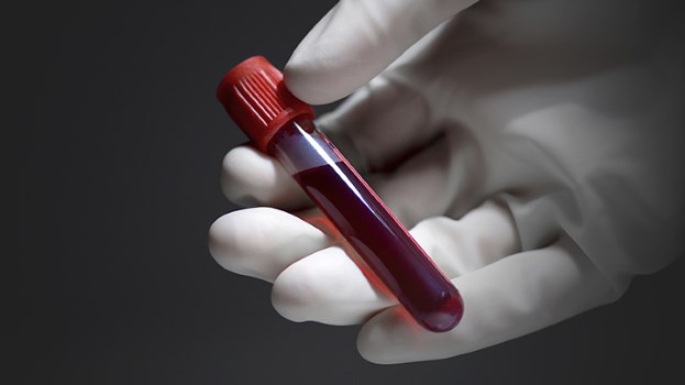 Gigante japonés crea tecnología para detectar el cáncer con una sola gota de sangre