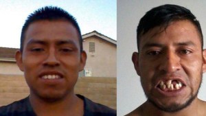 Un juego de futbol dejó a un migrante sin dientes, en coma y debiendo $105.000