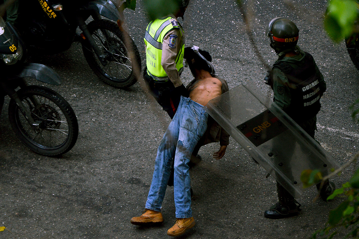 “Como muerto”… GNB manipula a un joven emboscado en El Rosal (FOTOS + VIDEO)
