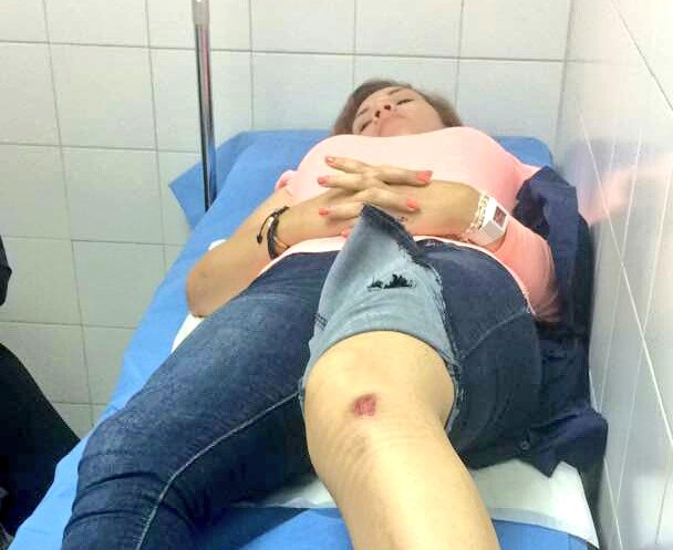 Sonaly Atencio, una de las activistas de Voluntad Popular herida durante represión en Maracaibo