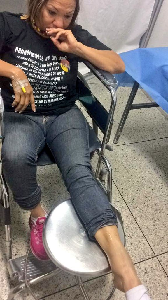 Yaritza Ramírez,, una de las activistas de Voluntad Popular herida durante represión en Maracaibo