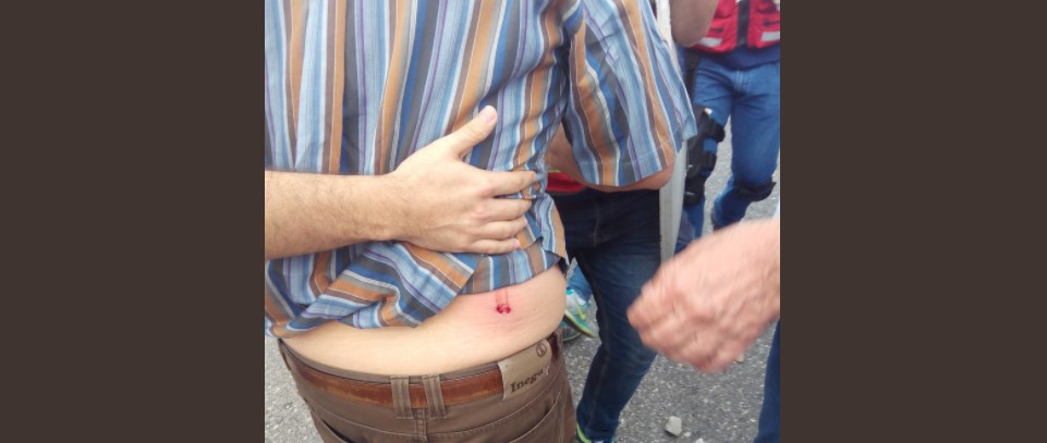 Diputado al Parlatino resultó herido durante la manifestación de este #29Jun en Lara