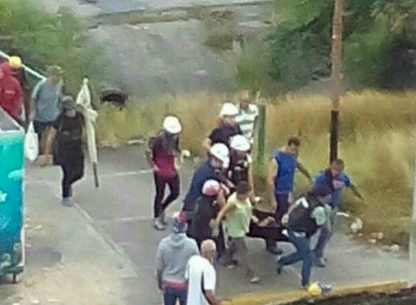 Foto: Joven herido de gravedad durante represión en El Cardenalito / Cortesía 