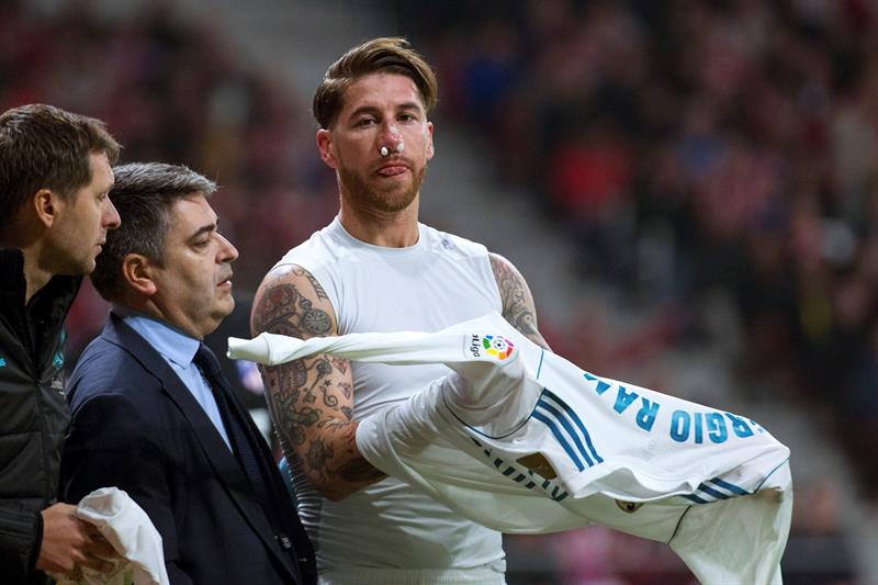 Ouchh… Un “señor zapatazo” dejó a Sergio Ramos con el tabique fracturado (FOTO)