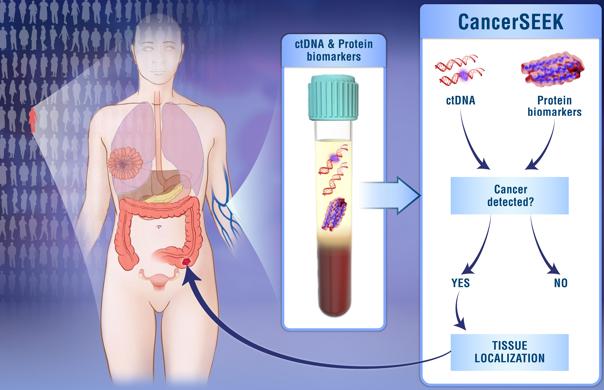 A partir de una muestra de sangre, la prueba analiza proteínas y biomarcadores que indican la presencia de cáncer - ELIZABETH COOK Y KAITLIN LINDSAY