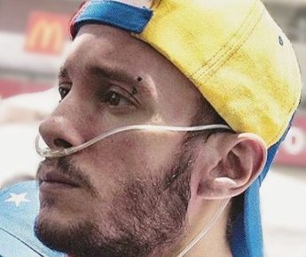 Falleció Gustavo Ramayo, estudiante que contrajo rara enfermedad por inhalar bombas lacrimógenas