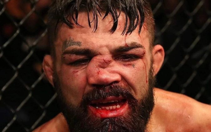 EN VIDEO: Un luchador de UFC termina con la nariz destrozada y la cara deformada por un rodillazo