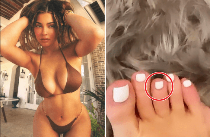 Kylie Jenner se ve obligada a explicar la extraña deformación en su dedo del pie