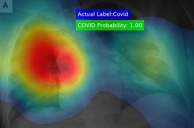 El poderoso software que puede detectar el coronavirus en cuestión de segundos y con una precisión del 98%