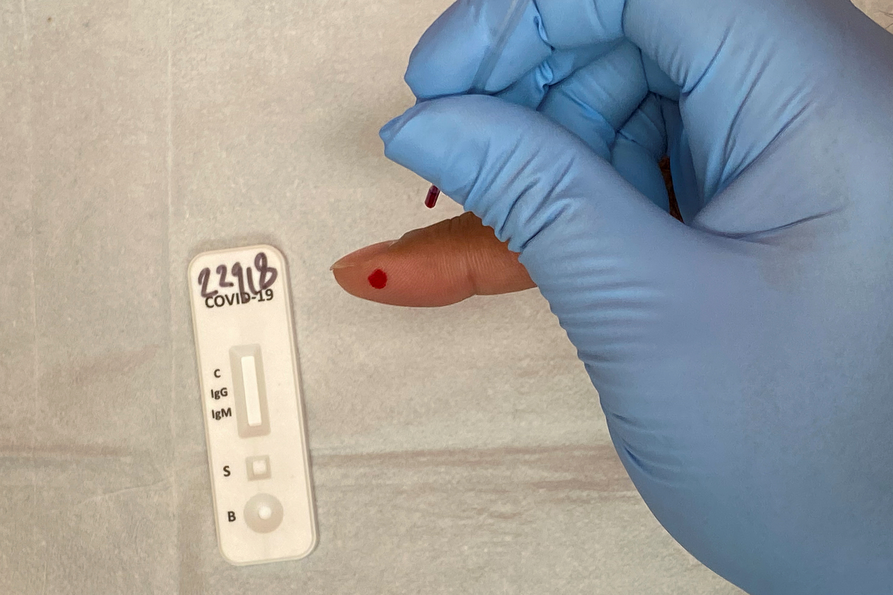 EEUU autoriza por primera vez un test de anticuerpos que se hace en casa