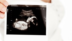 Maya, la bebé que nació con frondosa cabellera que ya era visible a las 34 semanas de embarazo (Fotos y video)
