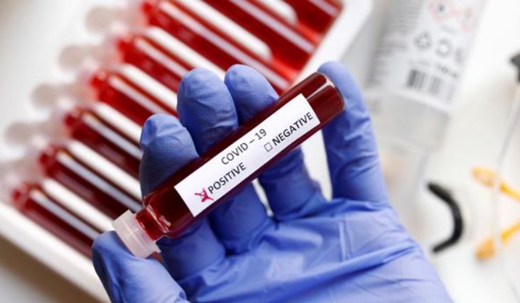 El grupo sanguíneo que se asocia con los casos más graves de Covid-19