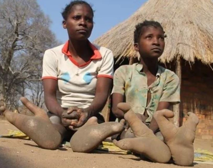 Vadoma, la misteriosa tribu africana cuyos miembros tienen “pies de avestruz”