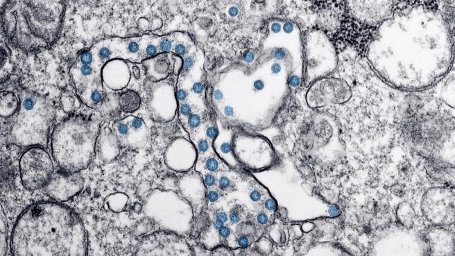 La liberación de patentes de las vacunas “no es suficiente”: Retos y próximos pasos para acabar con el coronavirus