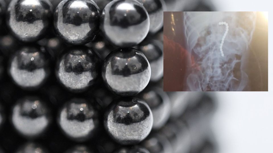 Niño de dos años casi muere en Orlando por tragar bolas magnéticas que venden en internet