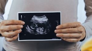Niña en Israel nació con el feto sin vida de su gemelo dentro de su estómago
