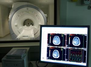 Científicos chilenos proponen un tratamiento contra el alzhéimer con nanopartículas de oro