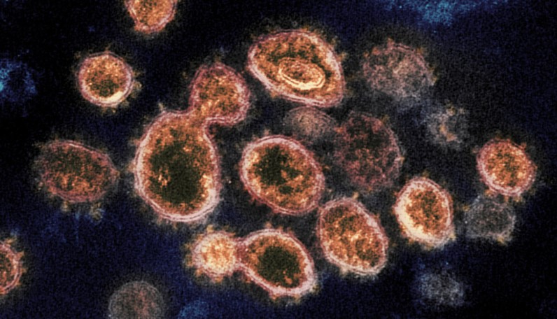 Respuesta inmune al SARS-CoV-2 es distinta a la de otros virus, según estudio