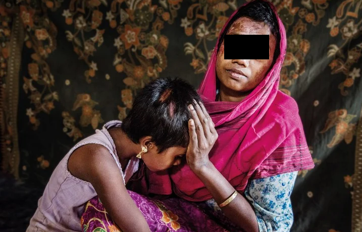 Desquiciado cosió los genitales de su esposa en India porque sospechaba que lo engañaba