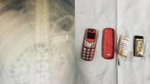 Equipo médico extrae un teléfono móvil del estómago de un preso en Kosovo
