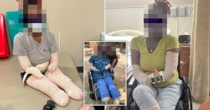 La devastadora historia de una madre que perdió las manos y los pies tras contraer el Covid-19 (VIDEO)