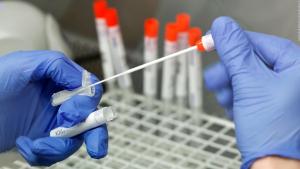 La República Checa confirma su primer caso de infección con variante ómicron