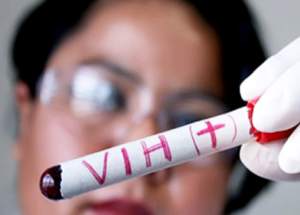 Persiste la desigualdad racial en las nuevas infecciones de VIH en EEUU
