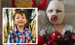 “Mamá, me prendieron fuego”: Niño sufrió quemaduras graves por un ataque por bullying en EEUU