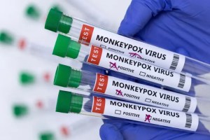 Cerca de 200 personas están siendo monitoreadas por la viruela del mono en Massachusetts