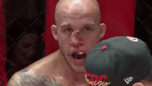 Imágenes sensibles: peleador de la UFC terminó con la nariz cerca de su cachete luego de un impactante golpe