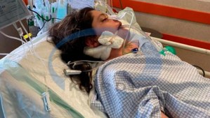 Nuevo giro en caso Mahsa Amini en Irán: médicos acreditados independientes aseguran que la muerte fue por golpes