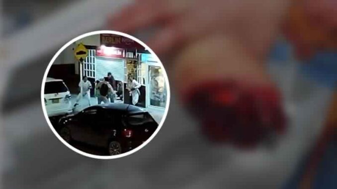 Se registró salvaje pelea con machete en Bogotá: Un hombre terminó sin un brazo