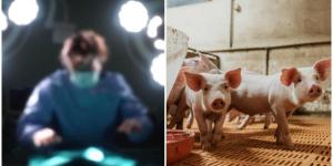 Equipo chino trasplanta con éxito riñón genéticamente modificado de cerdo a cuerpo humano